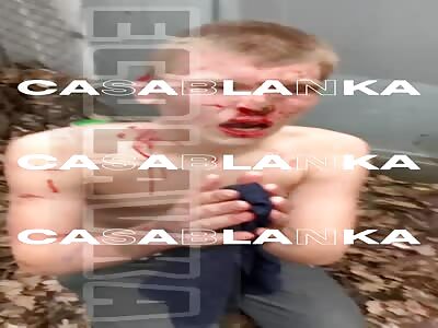 Young Russian drug addict was tortured for not paying his debts 