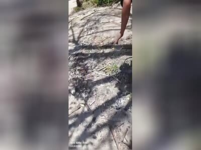 The Chinese man's leg was destroyed in the accident.