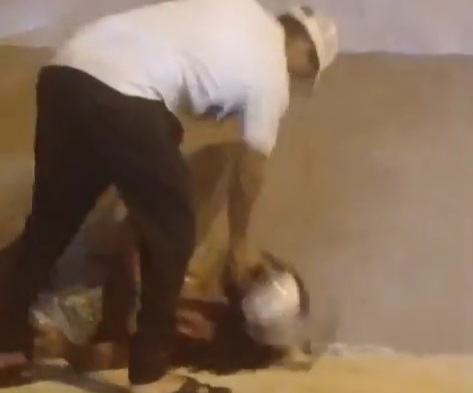 Street Hooker Nearly Killed by Lunatic Brazilian 