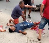 Motorcyclist loses leg in terrible accident 