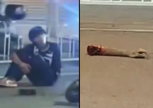 Motorcyclist lost his arm due to a Motorcycle accident 