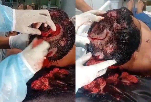 Jaguar Attack Survivor