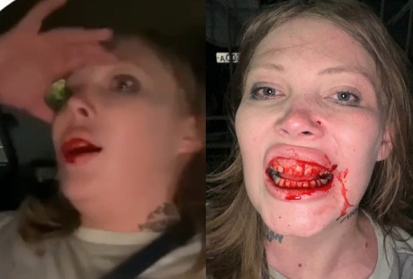 Woman Beaten By Her Fan During Live Stream