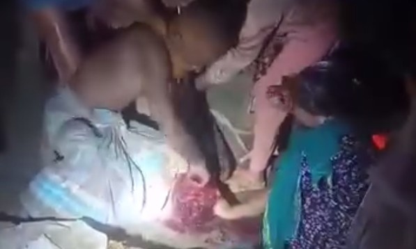 SHOCK: Siblings Gouge out Brother's eyes 'on Father 'Order'