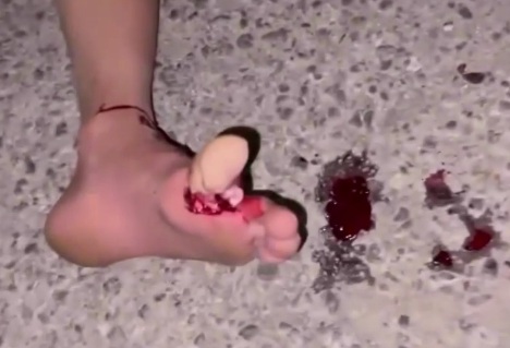 Motorcyclist crashed by speeding car 