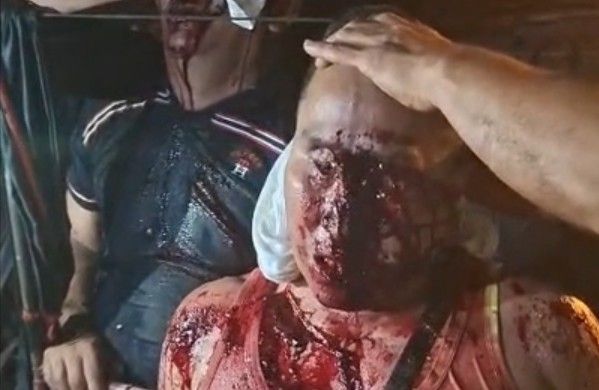 Sunday’s traffic lottery