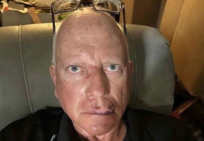 Elderly Man Beaten Up By Violent Teen At Rap Concert In Kansas City