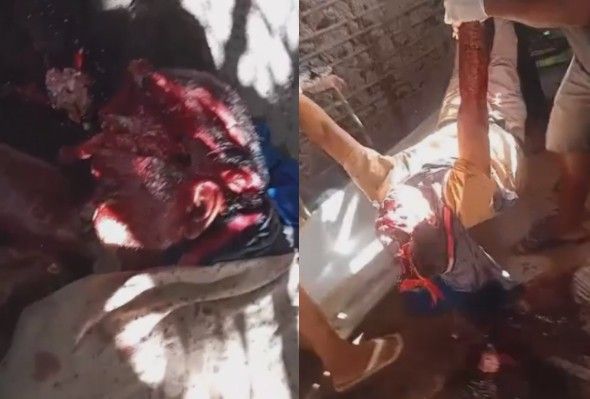 Bullet Cracked His Skull Like A Watermelon