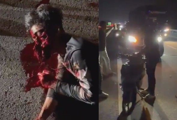 Man`s Face Turned Into Mess After Motorcycle Accident