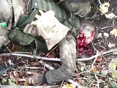 Russhit's face was torn off. Agony included.