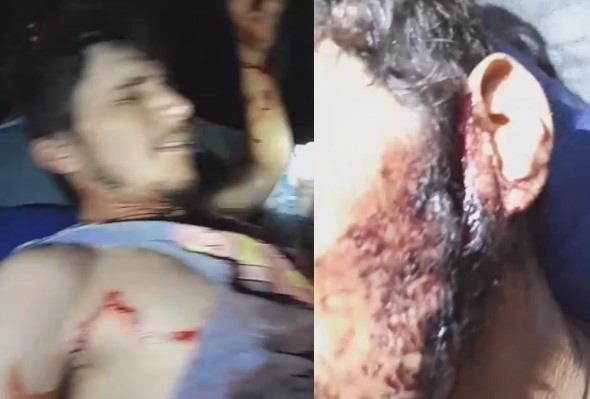 Jaguar Attack Survivor