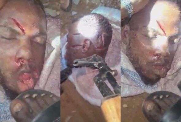 Gang Member Beheaded, Desacrated By Rivals