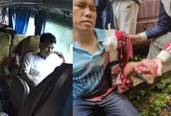 Man Loses Hand In Collision Between Truck And Bus