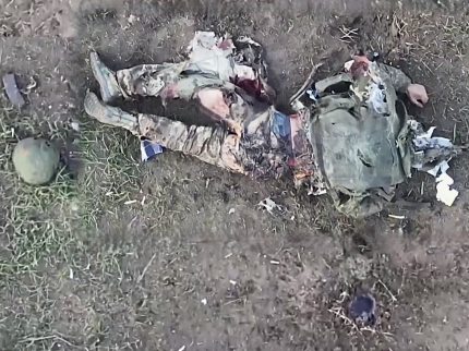 Blast Rips Off Russian's Glutes. Nasty, Bone-deep Wound Hurts. 