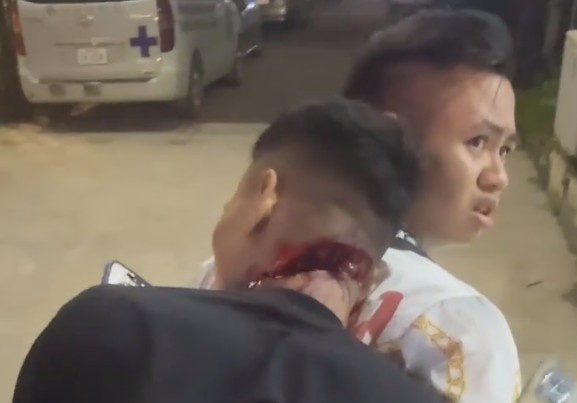 Somehow He Is Still Alive