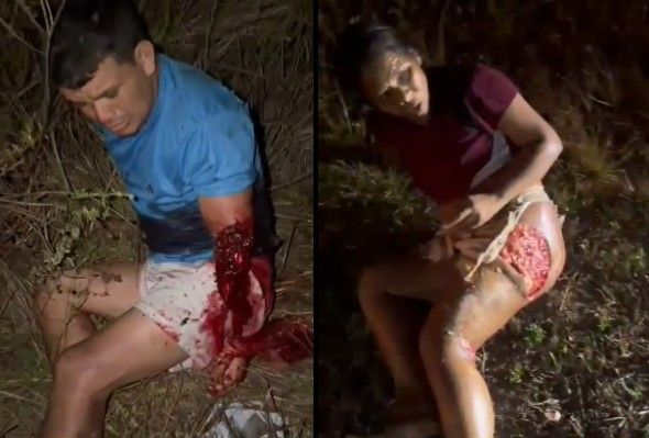 Couple Seriously Injured In Motorcycle Accident