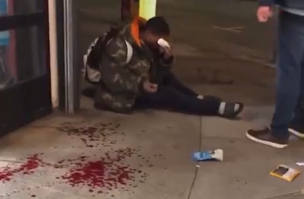 California Man Was Stabbed In The Eye When He tried To Stop Shoplifter