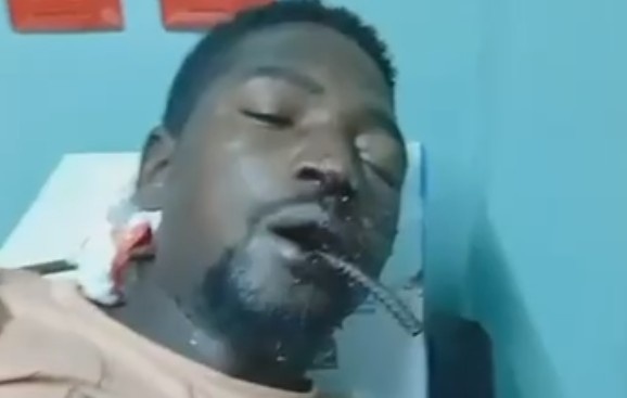 Haitian Man Impaled By Iron Rods (More Footage)
