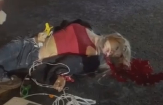 Cute Girl Critically Injured In Traffic Accident