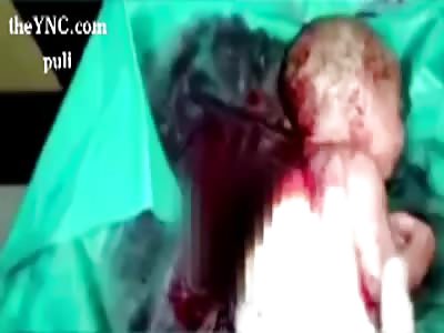 Jenin's martyrdom in Aleppo shrapnel pierced the body of his mother AFTER the bombing