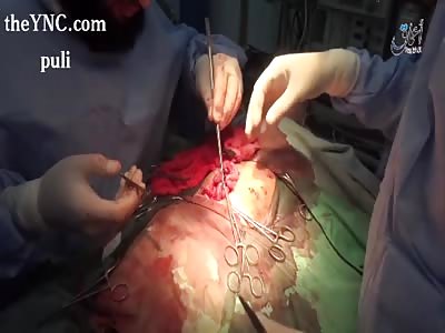 Victims as a result of the aerial bombardment and Turkish artillery of the city of the gate