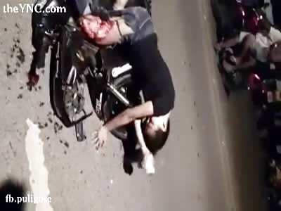 motorcycle accident...Ripped to the Bone Muscles Moving Around 