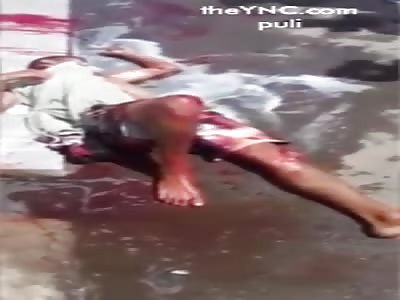 He was stealing a Hilux and got a bullet in the face