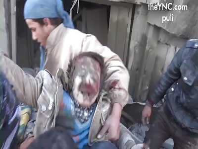 Mosul - dead and wounded of US aviation bombed