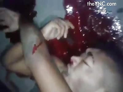 Everybody Wants to See the Bullet Holes in Agonizing Guy