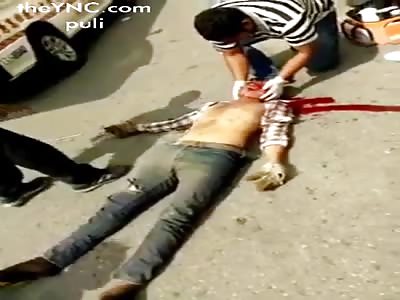 .Man suffers a terrible accident