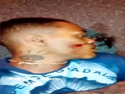 Receives shot for attempted theft