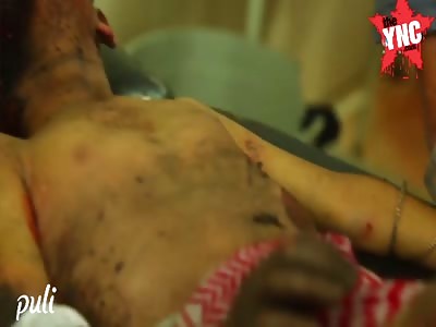 Aerial and artillery bombing of the American neighborhoods of the city of Raqqa