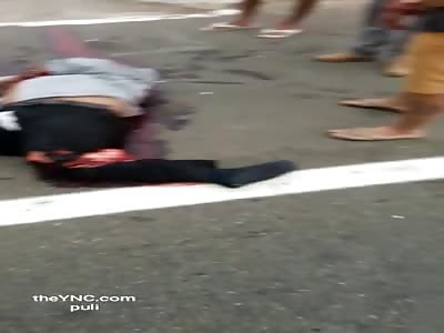 accident leaves with the leg shattered