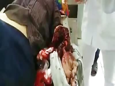 by putting your hand where you should not