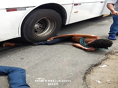 ACCIDENT leaves shattered leg (full video)