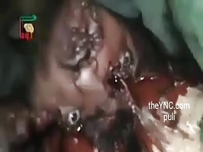 man with his head echo shit