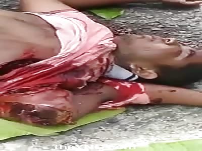 AGONY: Man with Arm Ripped in a Complete State of Shock 