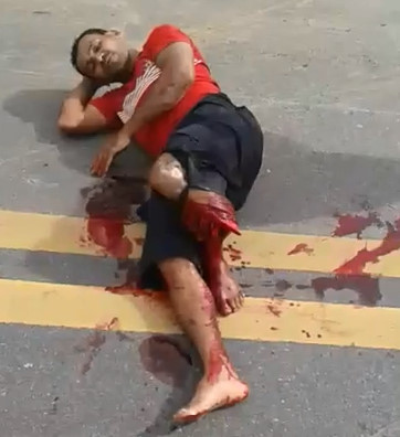 And THIS Might be the Most Fucked Up Leg I've Ever Seen