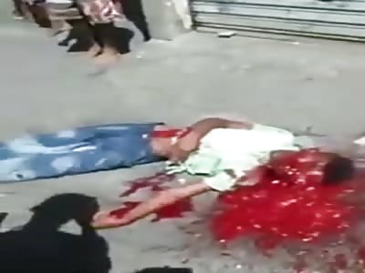 Man With Face Blown Off by Shotgun After Killed by Drug dealers