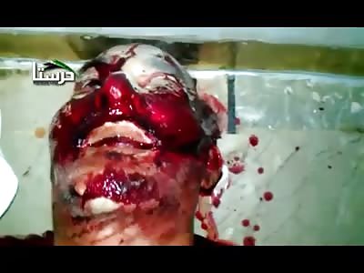 WAR. Consequences of air attacks