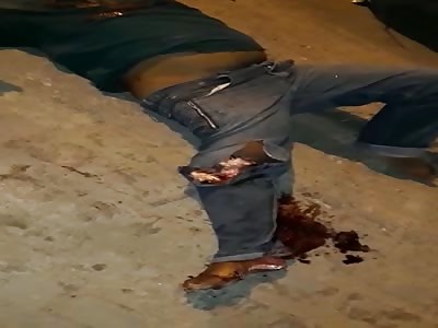 ACCIDENT leaves the leg shattered