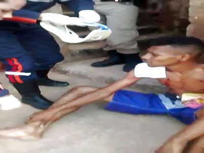 Victim of 5 shots in the chest. Speaking normally ... will it be the super man? Iron Man?