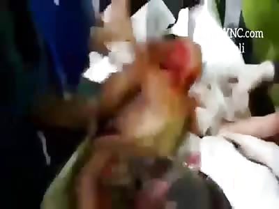 consequences of the Russian airstrikes