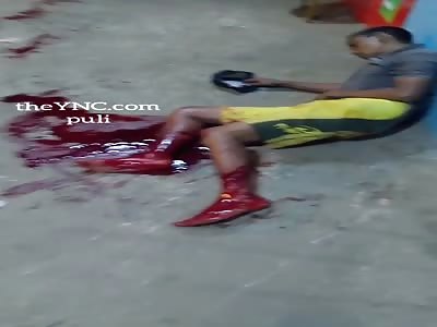 A 20-year-old boy died after cutting himself in the windw