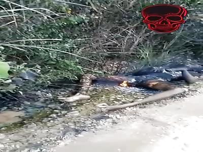 GIRL TOTALLY BURNED BODY