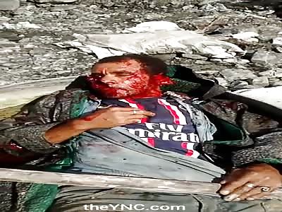 Man in AGONY has his face RIPPED OPEN by machete blows