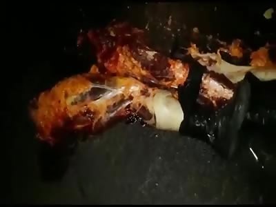 the watchman went to work lost his legs