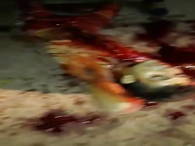 Man Still Alive With Half his Neck Gone From Machete Attack 