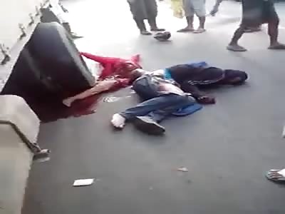 ACCIDENT: Girl Completely Turned in Half, Squirming Around 