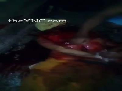 Inmate Repeatedly Stabbed in the Back by Other Inmates in Brazilian Jail